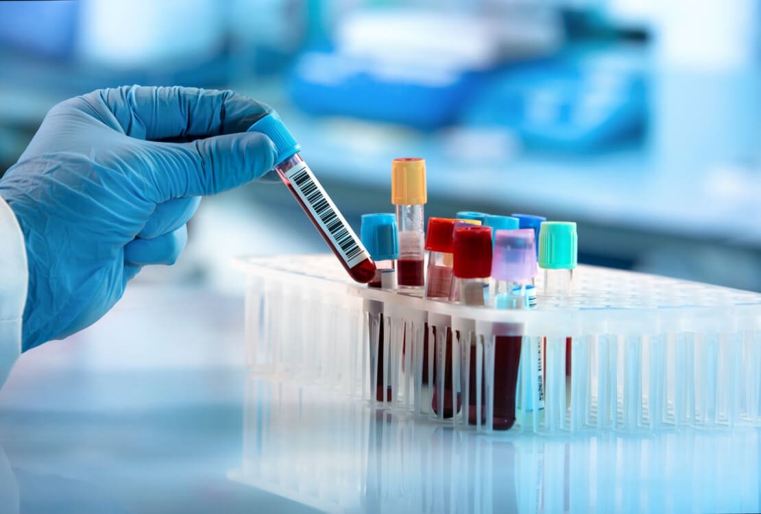 Laboratory at Stellar Diagnostic Centre Kharar